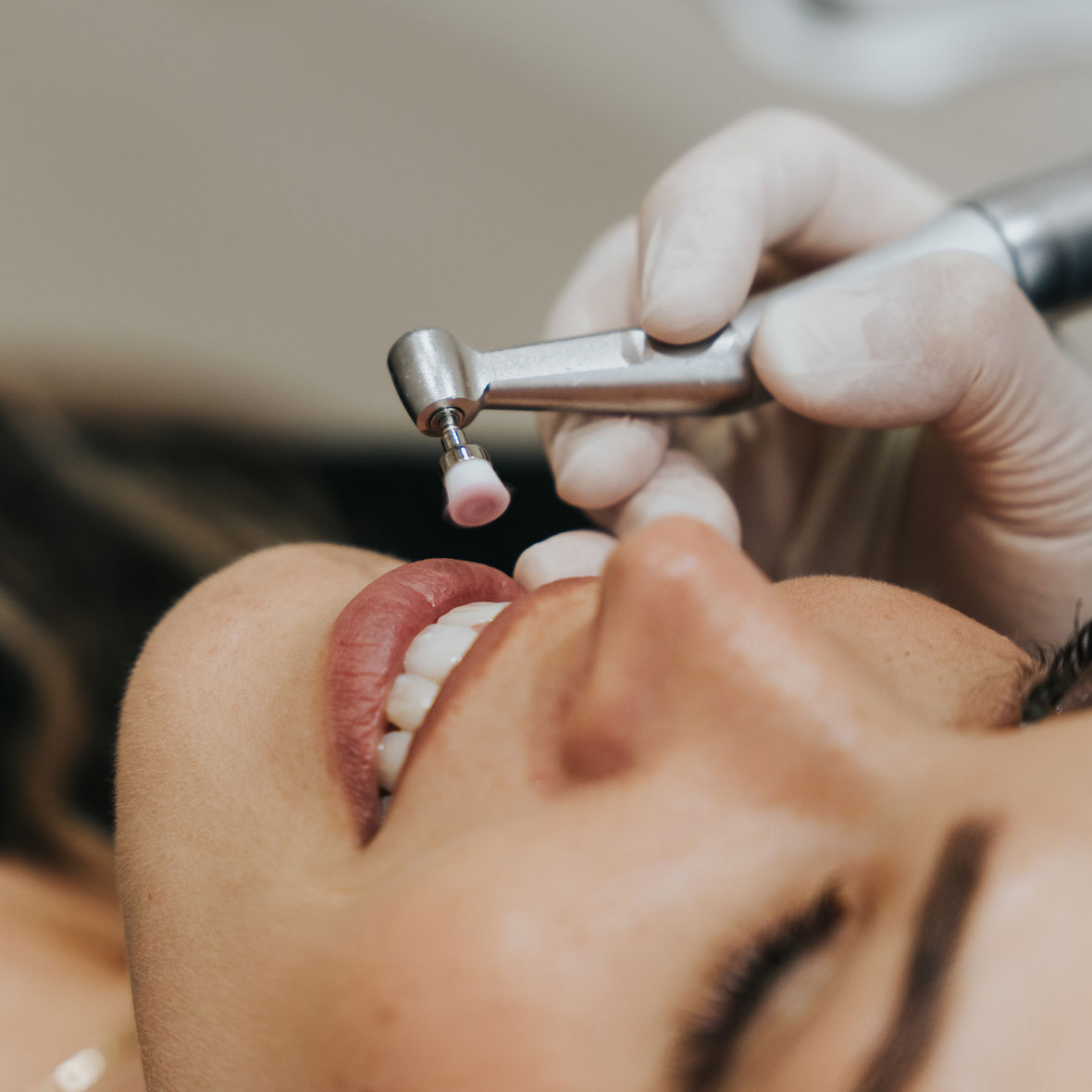 index_periodoncia_carousel04