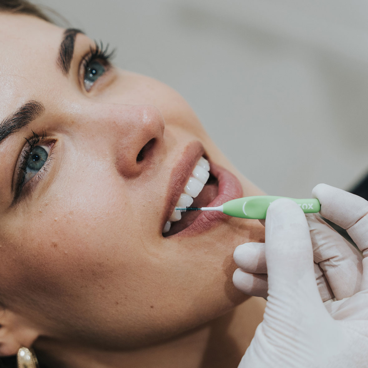 index_periodoncia_carousel05