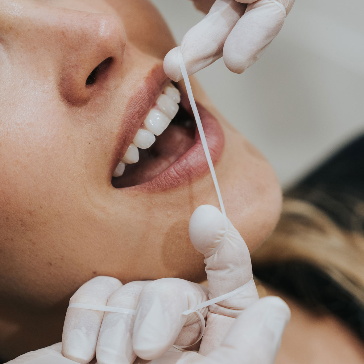 index_periodoncia_carousel06