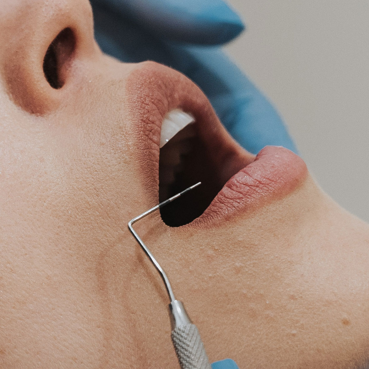 index_periodoncia_carousel08
